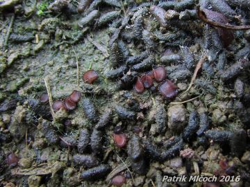 Mrvovka játrová